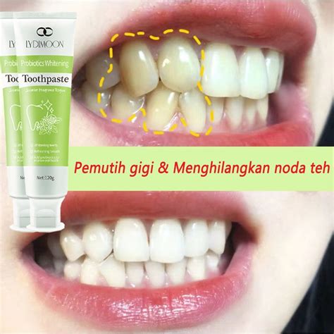 7 Tips Pemutih Gigi Alami Untuk Gigimu Lebih Kinclong