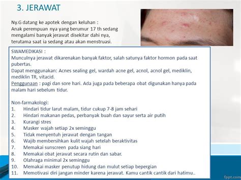 7 Rahasia Alami untuk Say goodbye Acne! 🤯