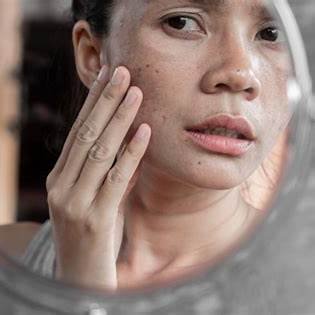 Melepaskan Ketergantungan Krim Dokter Ini Caranya!